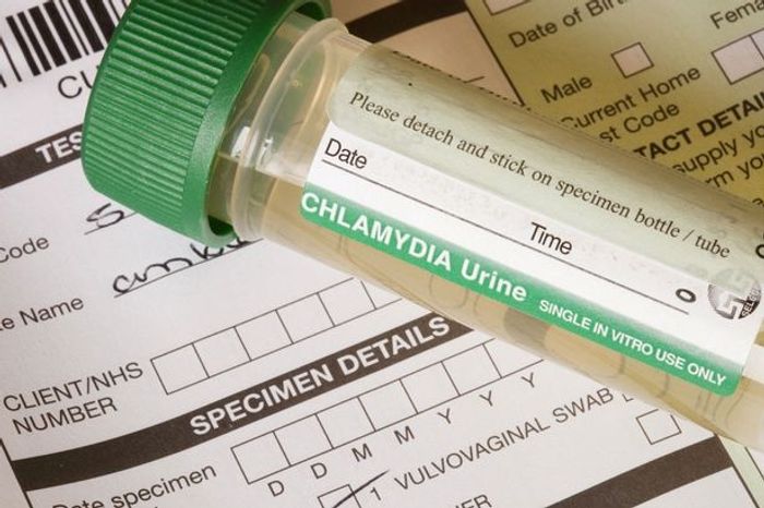 First successful steps towards a chlamydia vaccine | Image: SPL