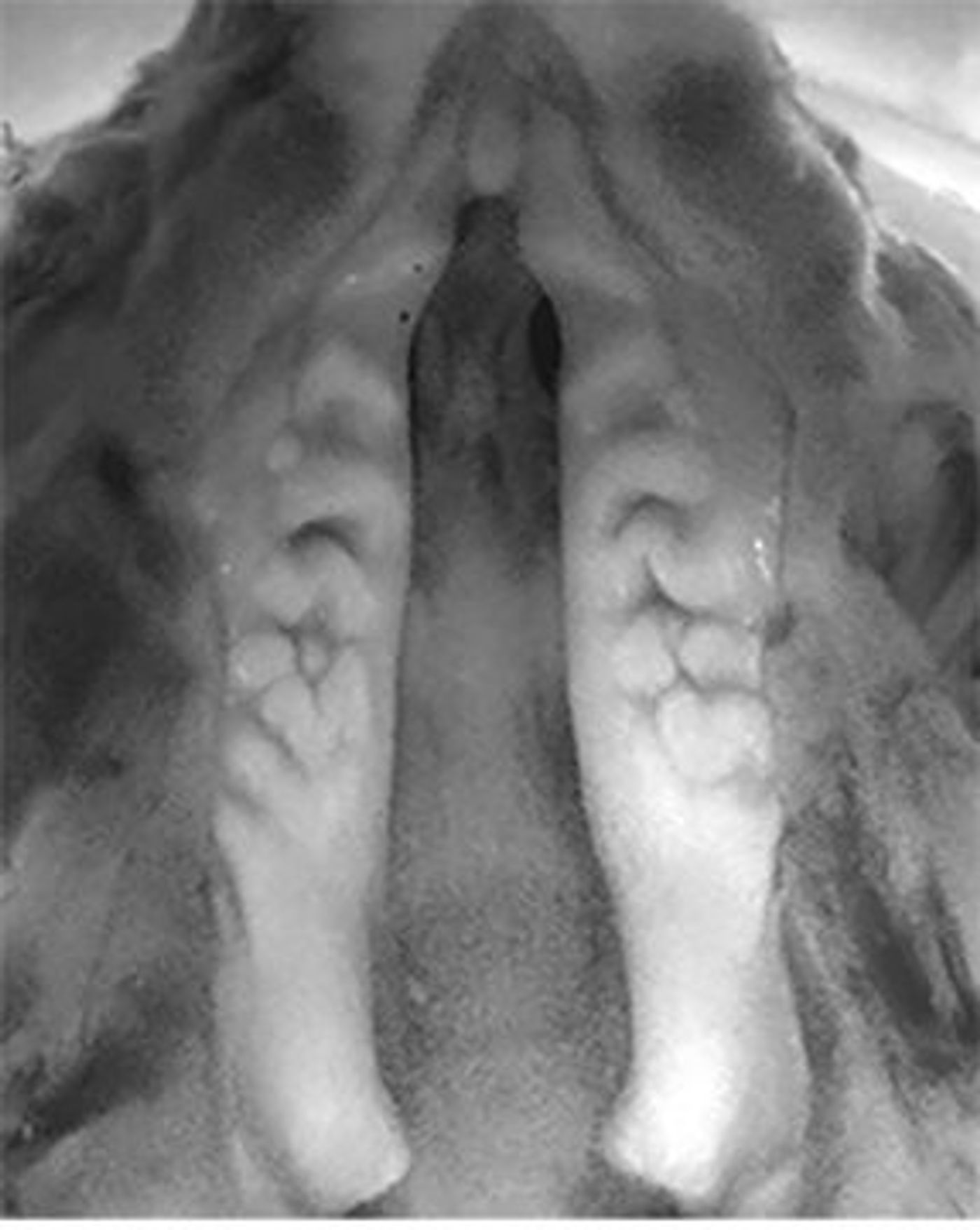 Cleft palate in a Pax9-deficient mouse embryo. | Credit: Rena D'Souza