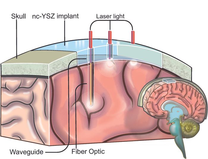 A biocompatible "window to the brain" | Image: UC Riverside