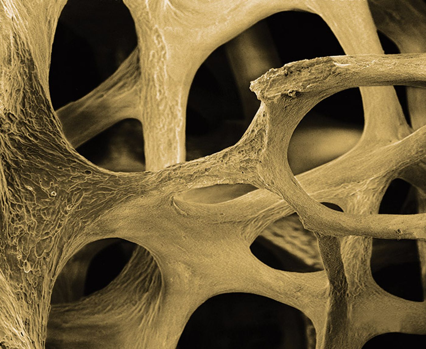 Nanoscale vibrations kickstart stem cells into bone cells | Image: ostinol.com