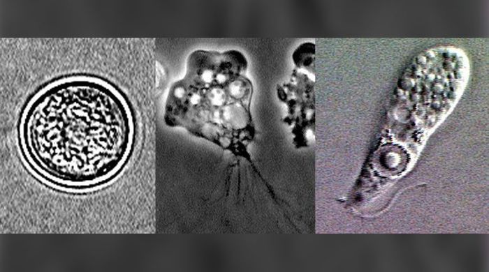 How a tiny amoeba can destroy the brain | Image: wikimedia