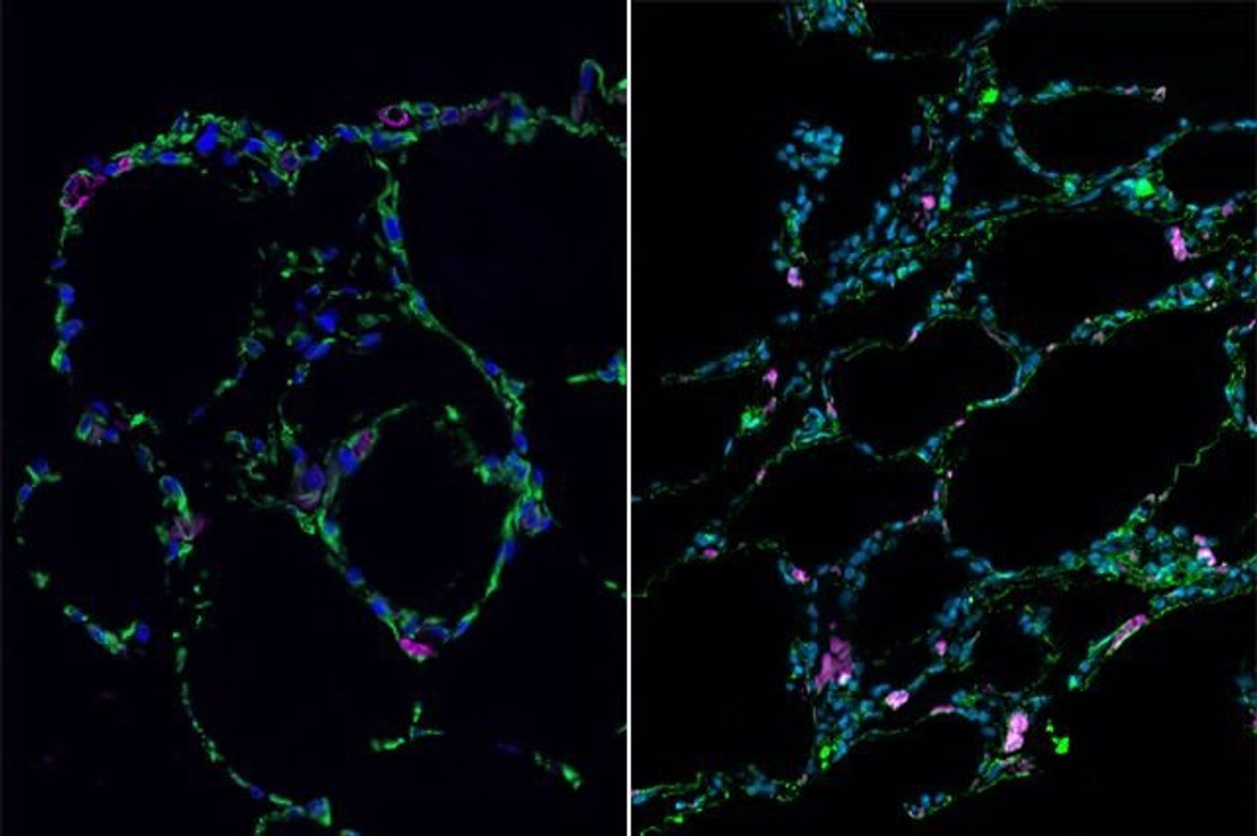 Lab-grown lung-like tissue (left) resembles adult human lung (right) | Image: UCLA