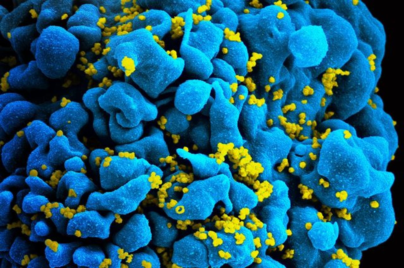 Technique to boost immune system to fight cancer can also fight HIV | Image: NIAID/Flickr