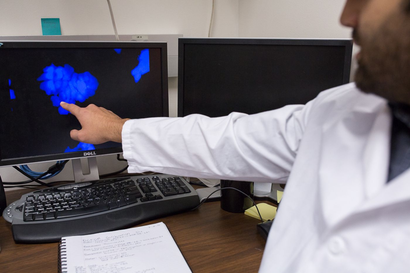 Justin Avila, a lab student points to cancerous cells that are destroyed using the 'acid trick.' | Image credit:Scott Ball.