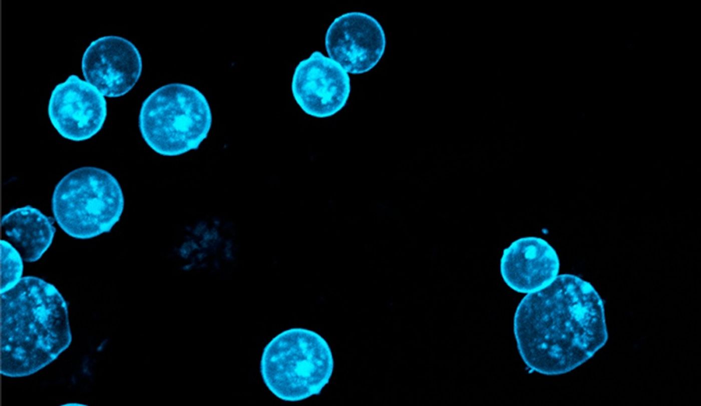 In many leukemia patients, blood cells carry a gene fusion that can lead to cancer-activating changes in gene expression. / Credit: Rockefeller University