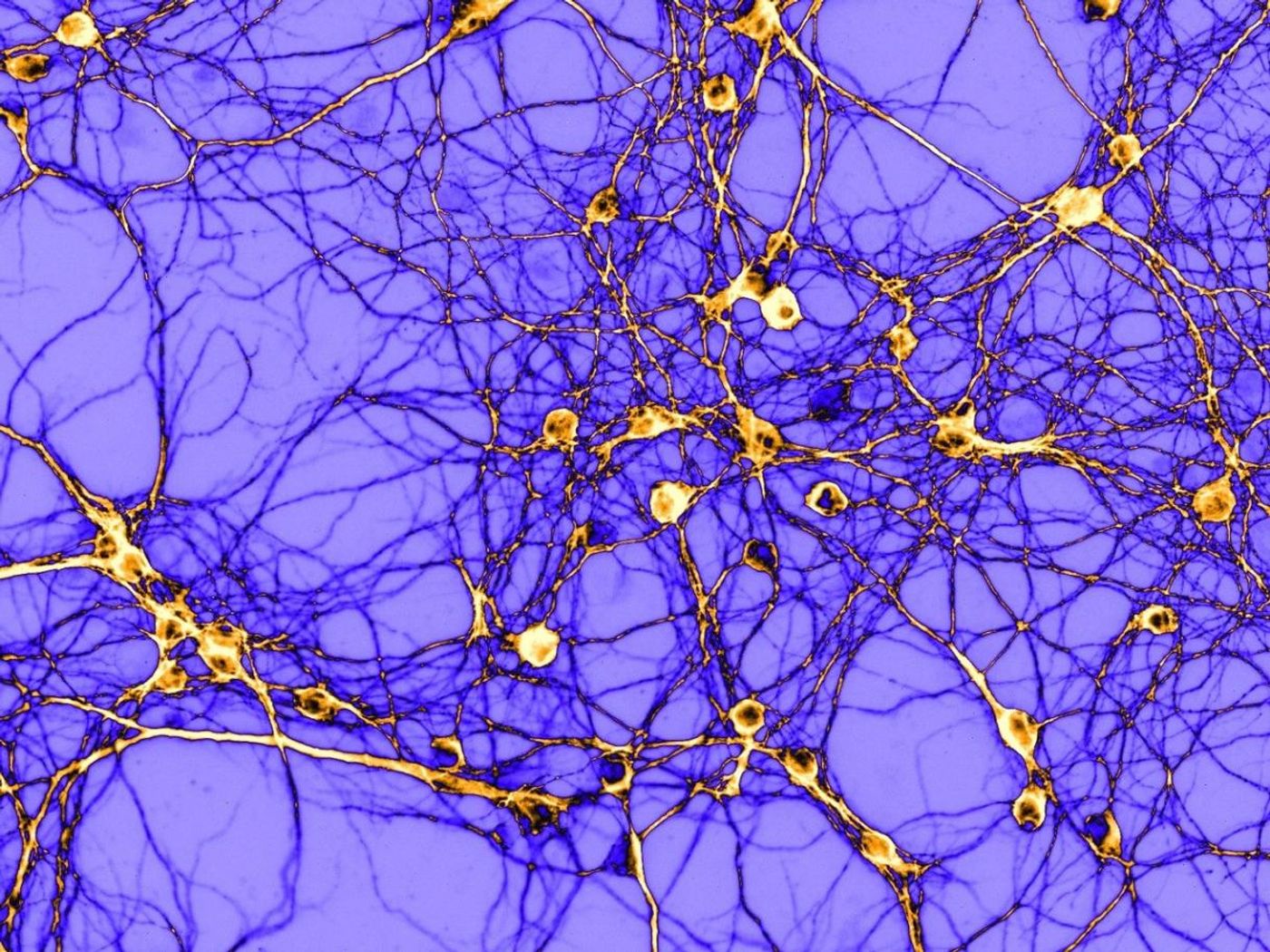 Cultured neurons from the striatum of mice | © Thomas Lissek / Hilmar Bading