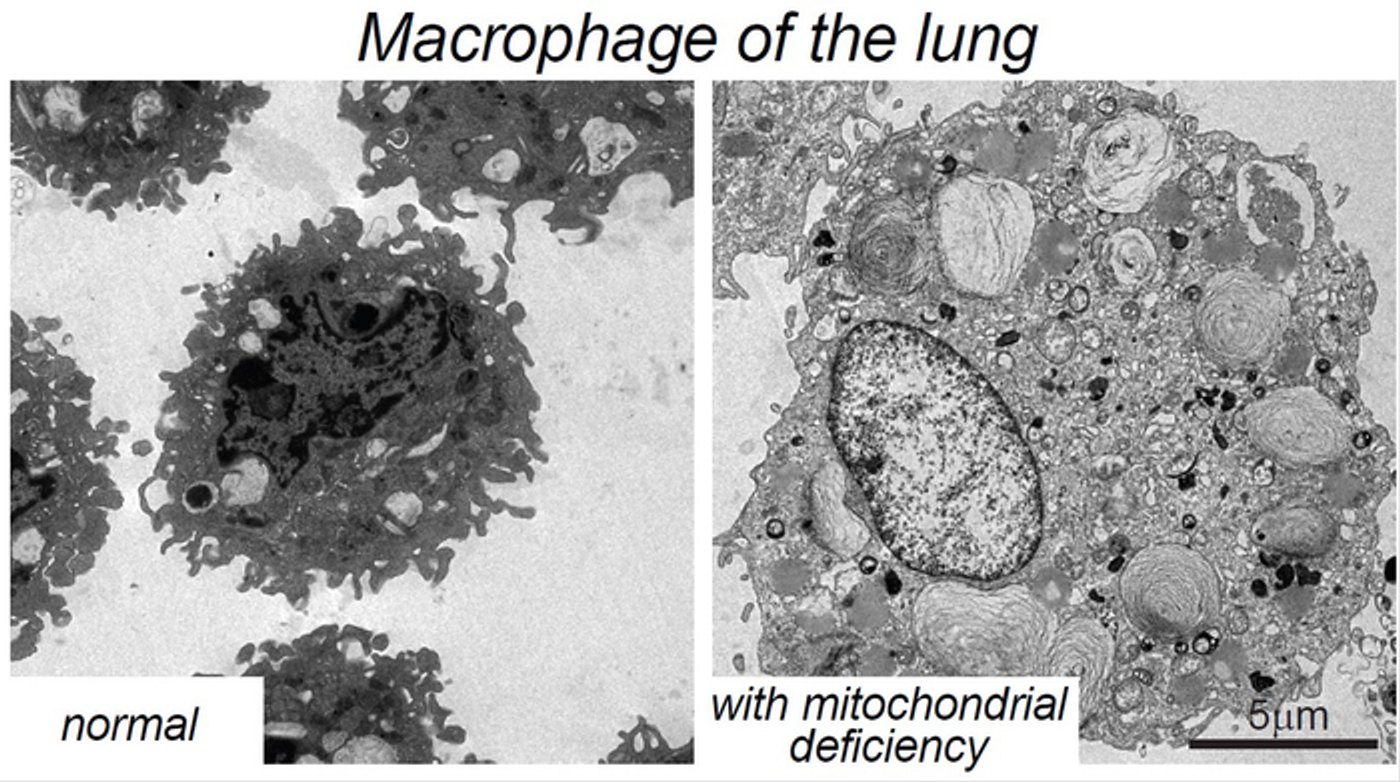 Electron microscopy shows lung macrophages in a normal mouse (left) and in a mouse lacking mitochondrial oxidative phosphorylation in lung macrophages (right). / Credit: CNIC