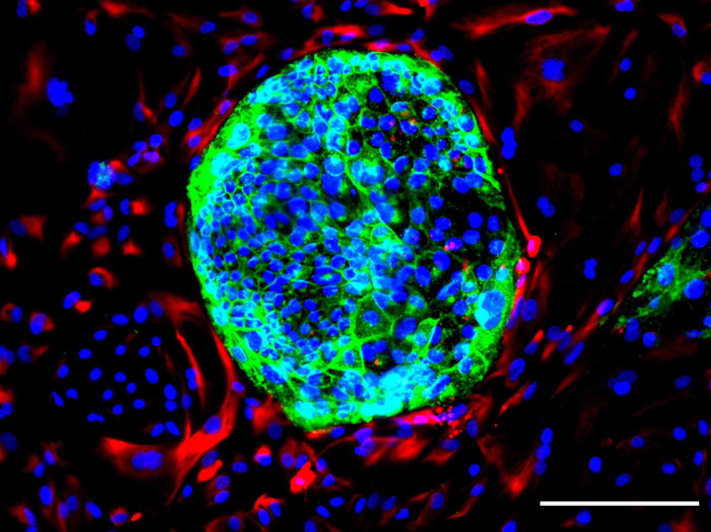 Transforming the cell therapy landscape with stem cell robots