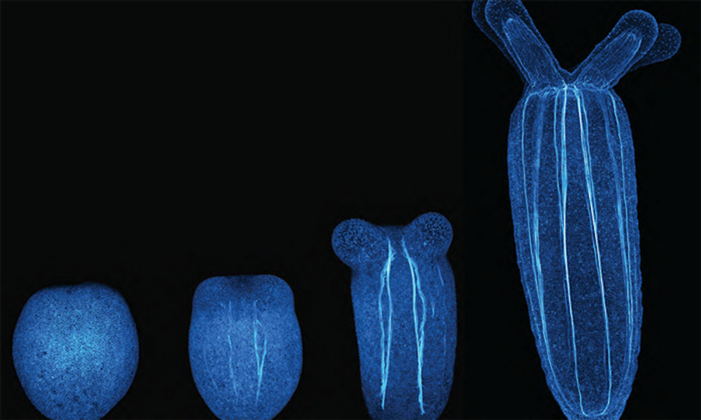 Sea anemones tissue is visualized with actin-staining. / Credit: Ikmi group/EMBL and ALMF/EMBL