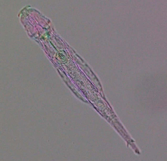Bdelloid rotifer (Adineta vaga) under polychromatic polarization microscope. / Credit  M. Shribak and I. Yushenova