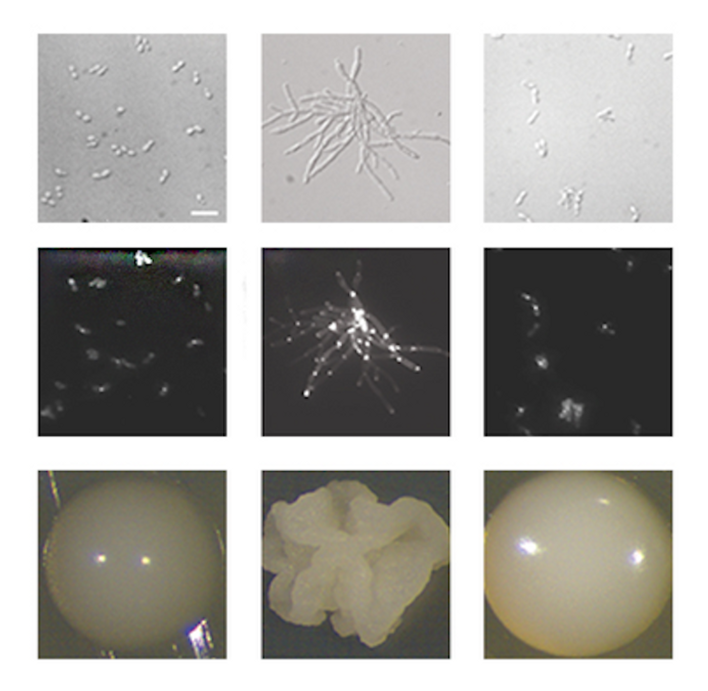 Strains of Candida auris in yeast and filamentous form Credit  Darian Santana