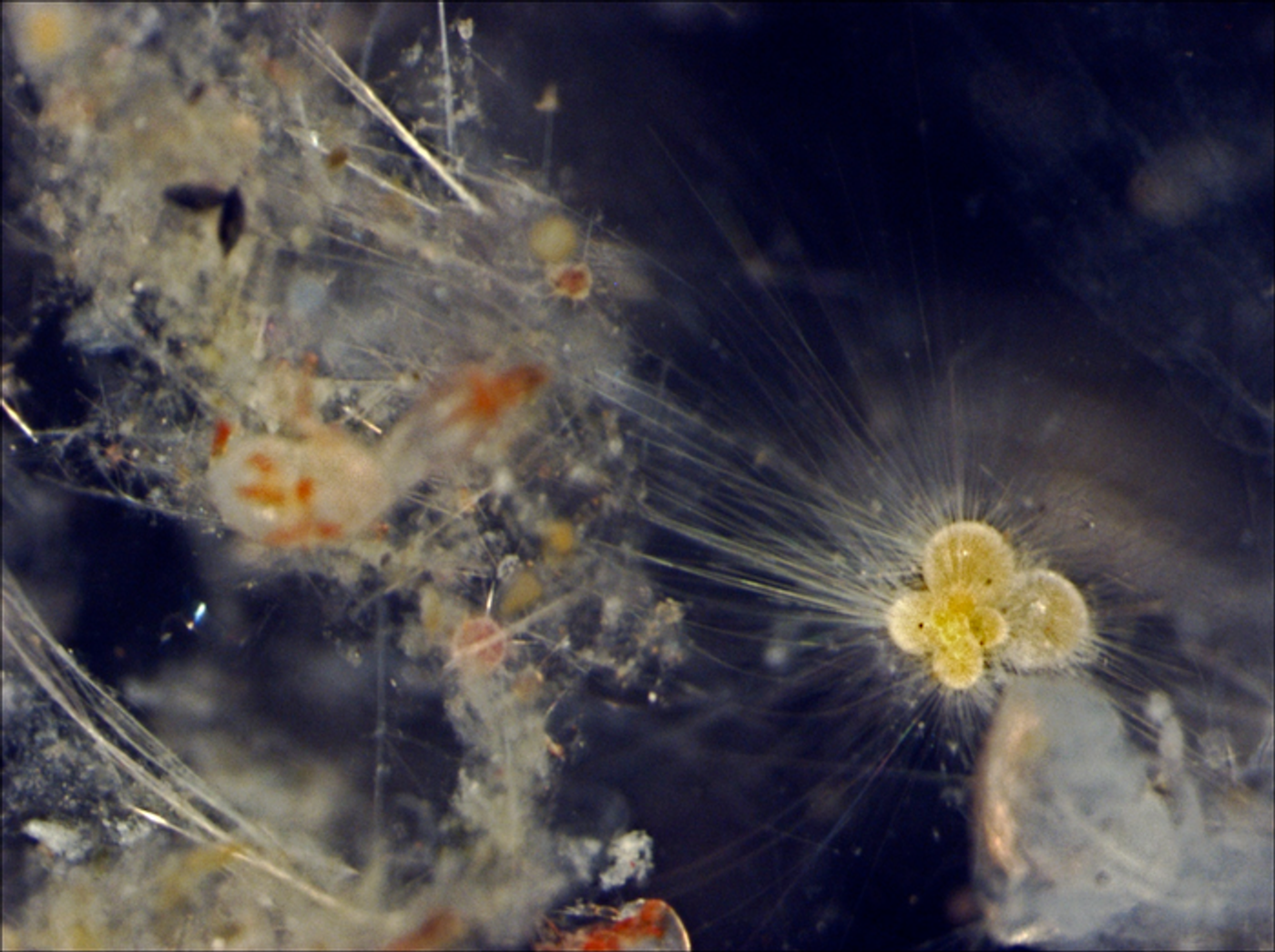 A light microscope image of a planktonic foraminifera (yellow object, bottom right) surrounded by thin strands of its cytoplasm extending into the surrounding environment. This living specimen had recently been collected from the Southwest Indian Ocean during the GLOW Cruise. (Credit: Tracy Aze, University of Leeds)