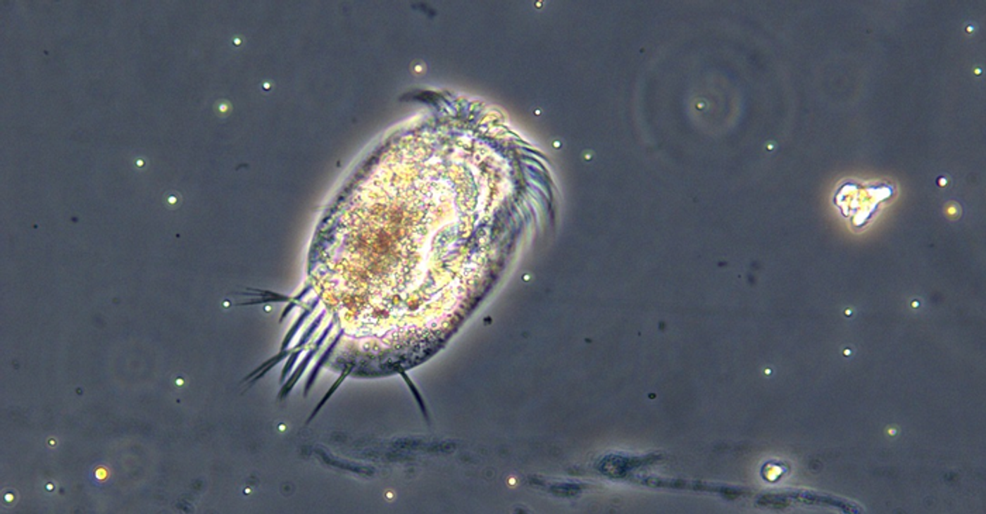A protist can be seen in this image, courtesy of Dan Wieczynski