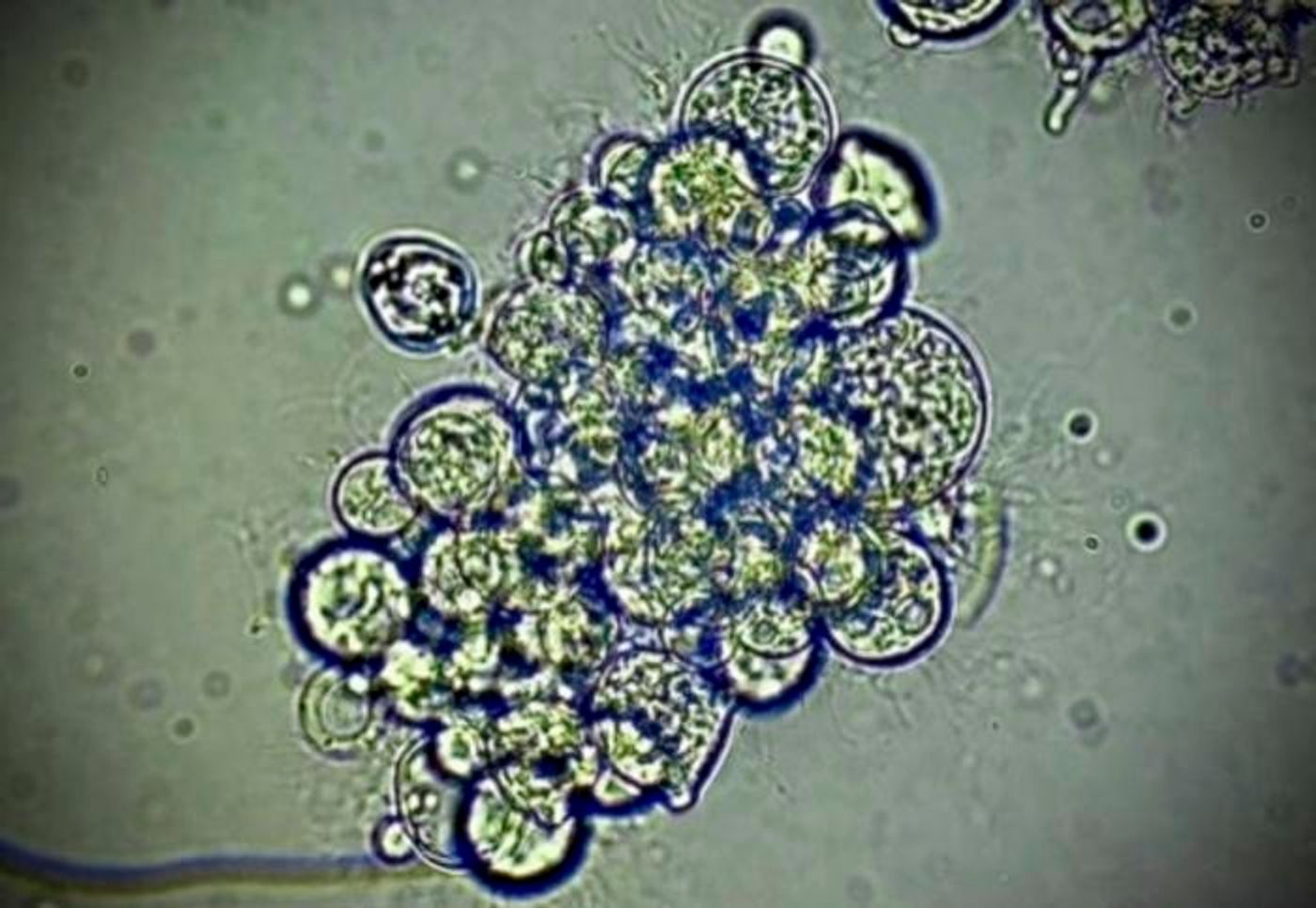 Spore producing structures of the fungus Bd. /  Credit: Mark Yacoub/UCR