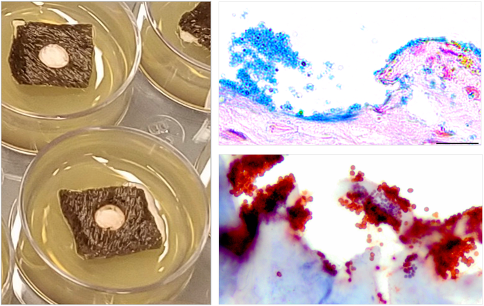 The equine model; skin explants in culture (left), bacterial biofilms stained with Alcian blue (upper right), an anti-bacterial antibody (lower right) reveal the presence of bacteria. / Credit: AlphaMed Press