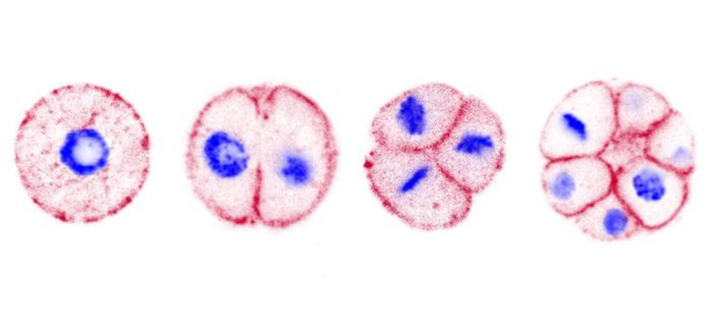 Expansion microscopy reveals the membranes (red), and DNA (blue) of the ichthyosporean Chromosphaera perkinsii during a development process / Image credit: © O. Dudin - UNIGE