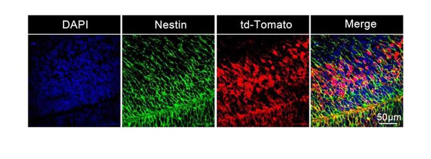 Staining of the neural stem and progenitor cells in the fetal brain transfected by Cre mRNA delivered by LNPs / Credit: UC Regents