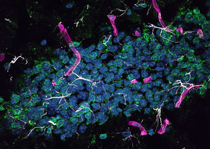 Hippocampal dentate gyrus in HSHA mice, showing significant astrocyte activation (GFAP: white) and oxidative stress (8OHdG: green) surrounding the cerebral capillaries (laminin-a4: magenta). Nuclei staining with DAPI (blue). / Credit  John Charles Louis Mamo, Lam V et al., 2021, PLOS Biology, CC BY 4.0 