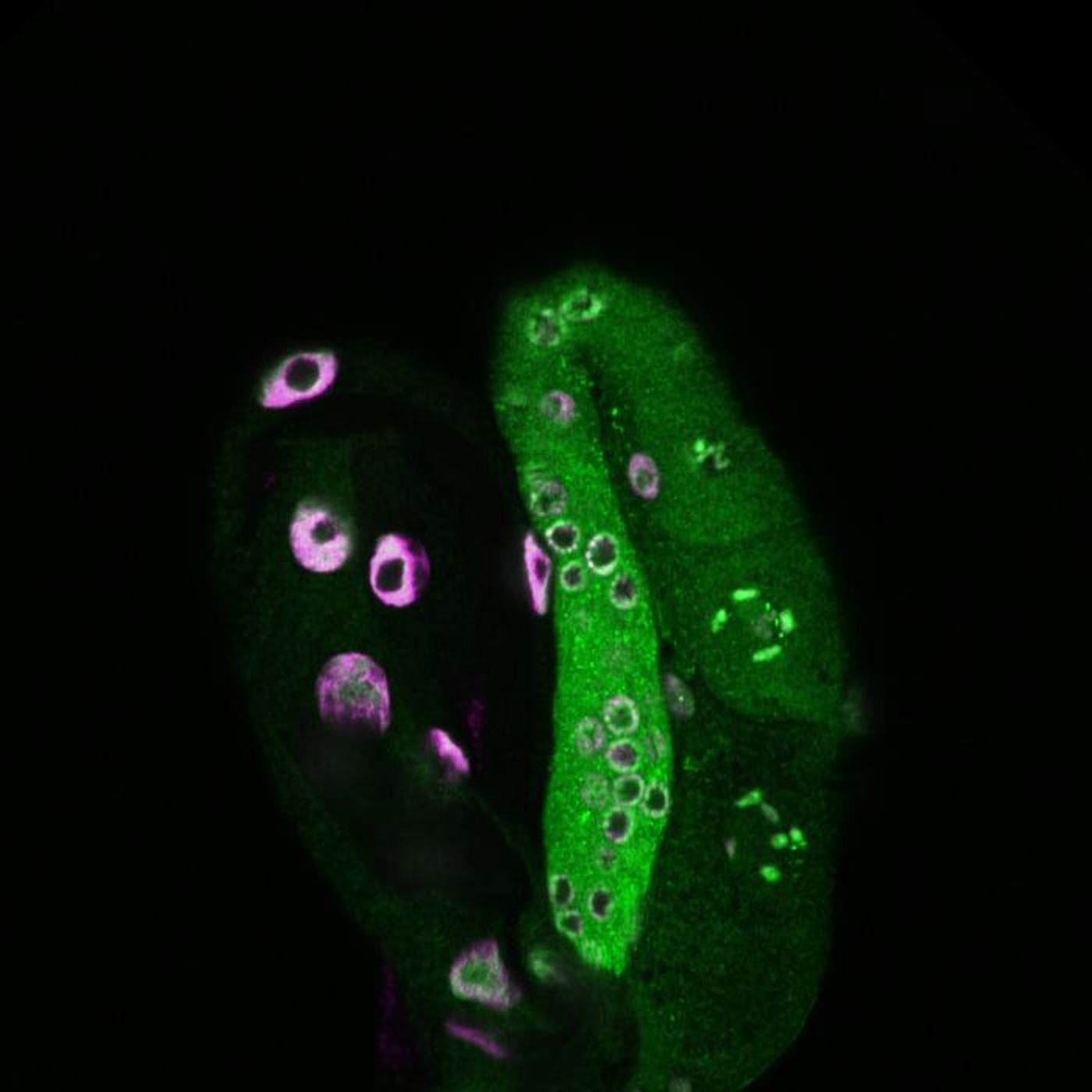 A tulip-shaped image of a worm shows the intestine on the left and the germline on the right. Green highlights histone H3 lysine 79 dimethylation, while magenta marks cell nuclei stained with DAPI.  Credit  Meng Wang