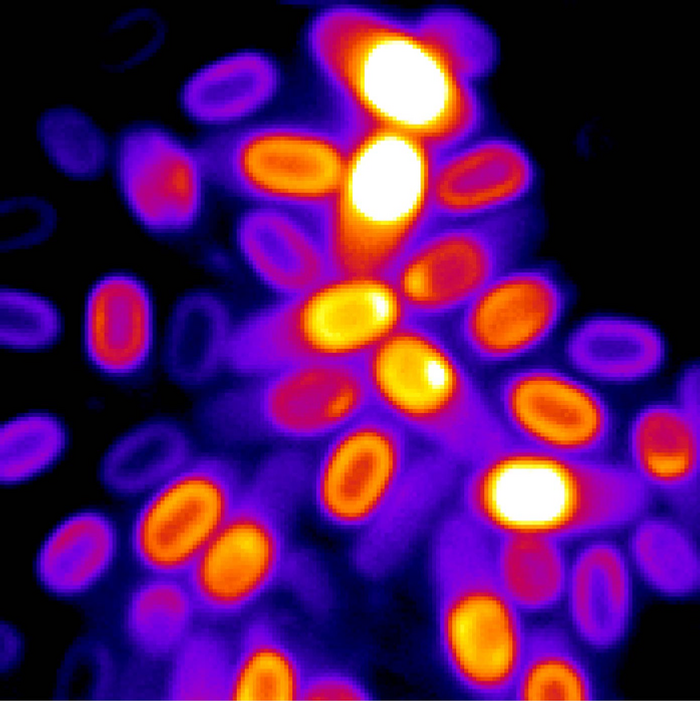 A microscopy image reveals several spores with their electrochemical potential color-coded according to the strength of the signal. / Credit: Süel Lab - Kaito Kikuchi and Leticia Galera