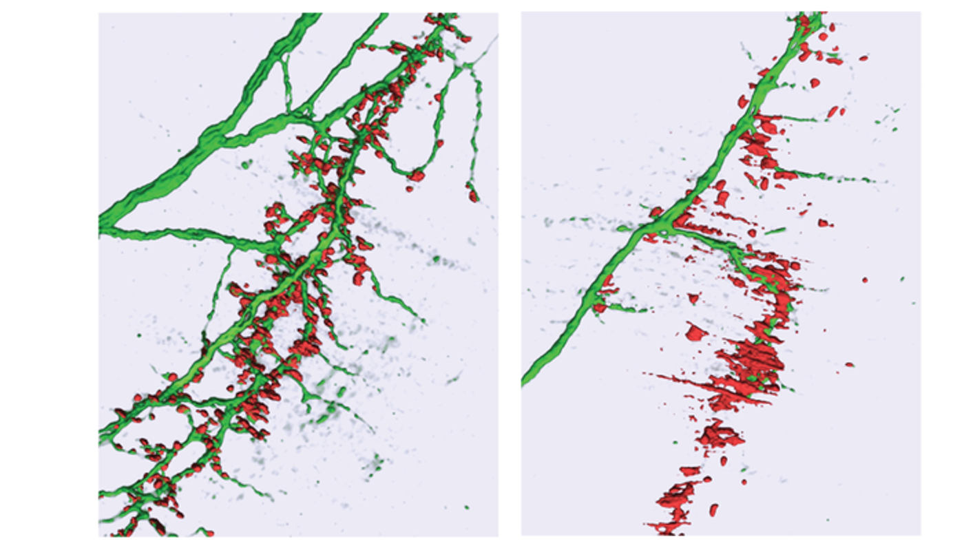 A computer-aided reconstruction showing loss of microRNA-218 (right side) may disrupt neuromuscular synapses and result in breathing muscle paralysis. / Credit: Neal Amin