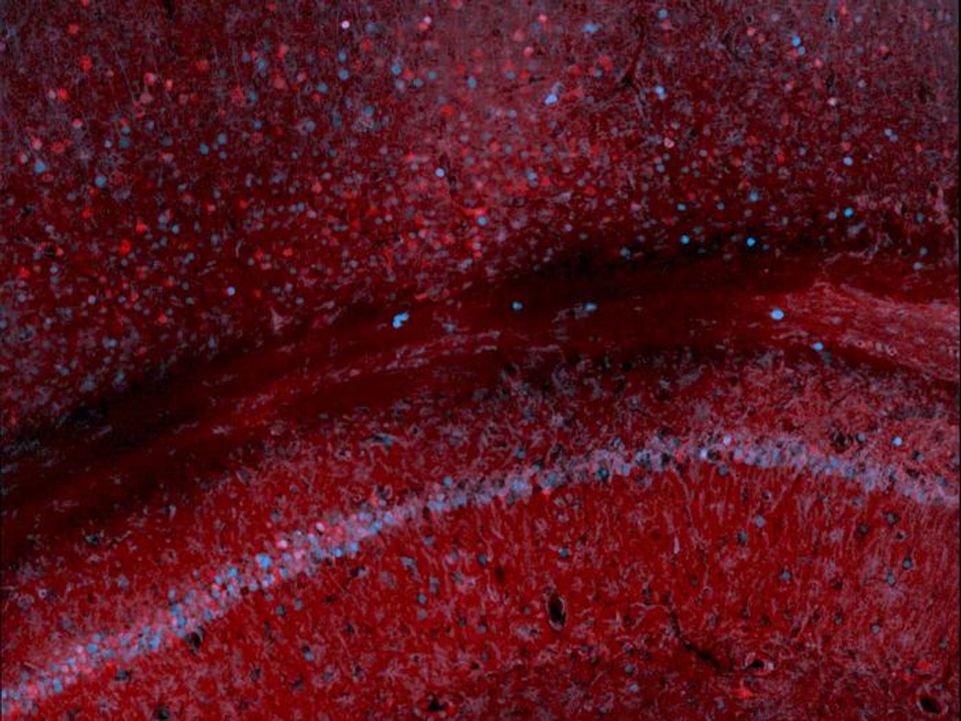 Scan of mouse hippocampus and cortex: immunostaining for the synthetic marker developed by the Szablowski lab (red) and c-Fos (blue) a natural protein which is a marker of increased neuronal activity. / Credit: Image courtesy of the Szablowski lab/Rice University