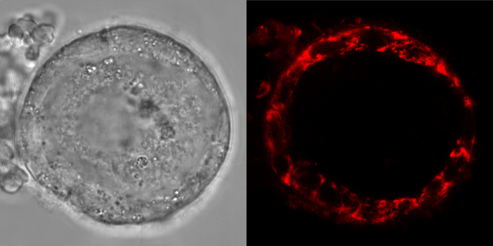 Live cell imaging of human follicle; granulosa cells are on the outer layer and the oocyte is within. Reactive oxygen species activity (red) is seen in granulosa cells but is virtually absent in the oocyte. Credit: Aida Rodriguez/Nature