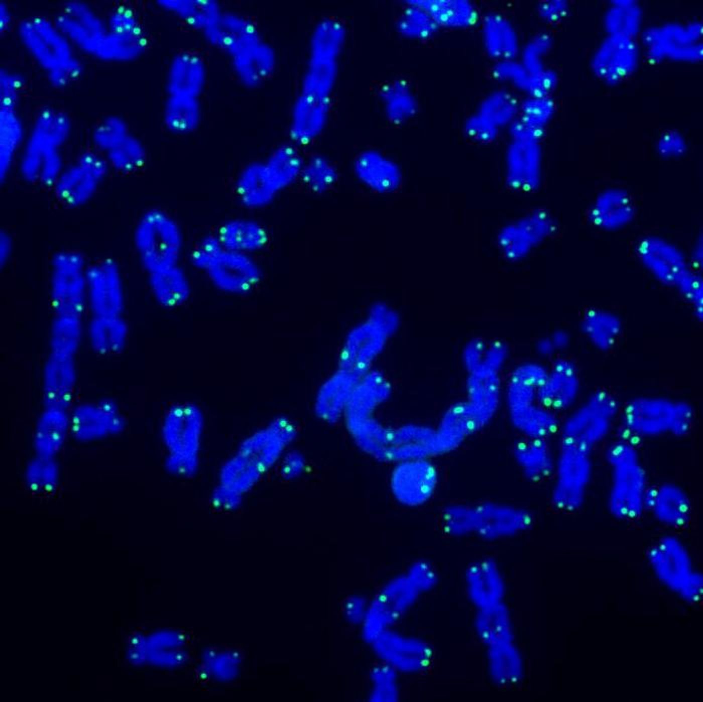 Telomeres (green) protect the ends of our chromosomes (blue), but lose this protective capacity as we age.  Credit  Salk Institute