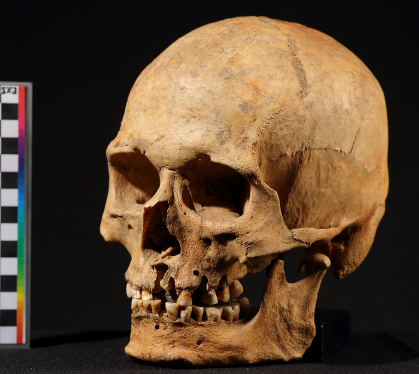 A skull belonging to one of the individuals discovered during the Kamchatkan River excavation. Image credit: Sergey V, Semenov