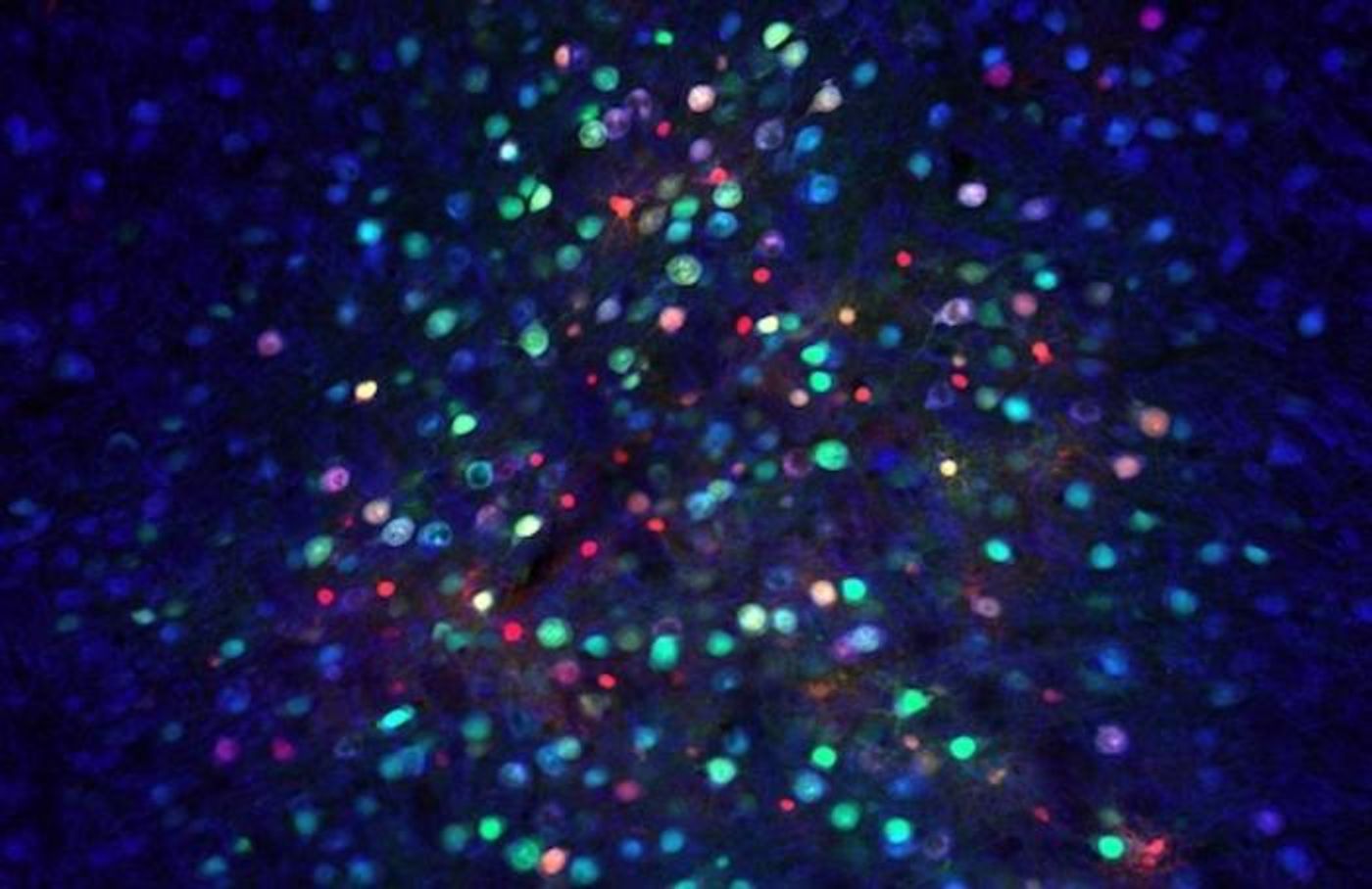 Noninvasive gene delivery to the brain with the new engineered vector (green) or a commonly-used gene therapy vector (red)./ Credit: Image courtesy of Rice University.