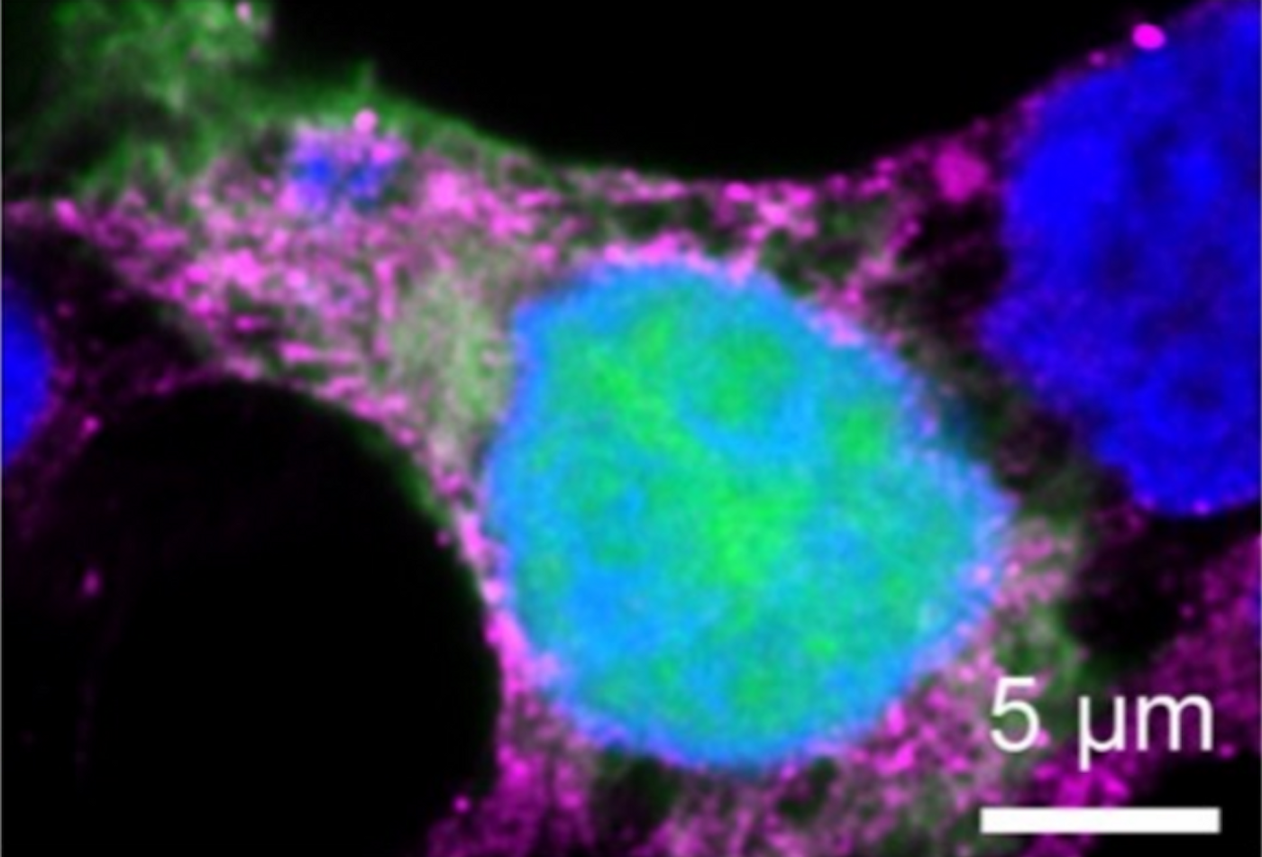 Cellular proteins that may interact with Lassa virus polymerase during viral replication are labeled. Engineered LASV L-TurboID (magenta), host cell proteins that interact with viral polymerase (orange), and viral polymerase (green) are seen. / Credit: Scripps Research