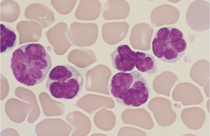 Virus-induced leukaemia cells Credit: Dr Yoshikazu Uchiyama