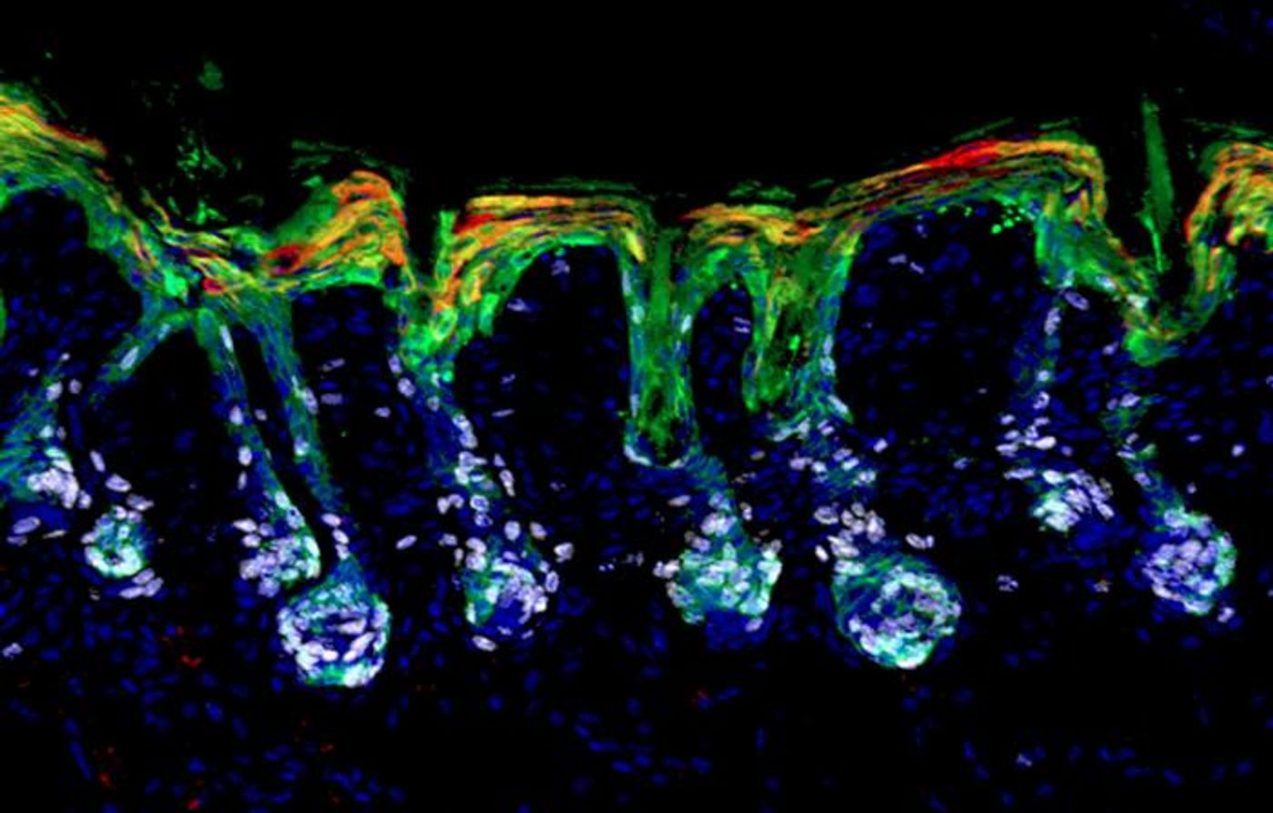 Hair follicle stem cells (green) mobilize and expand (white) to help repair the skin's barrier by differentiating into epidermal lineages (red). / Credit  Robin Chemers Neustein Laboratory of Mammalian Cell Biology and Development at The Rockefeller University