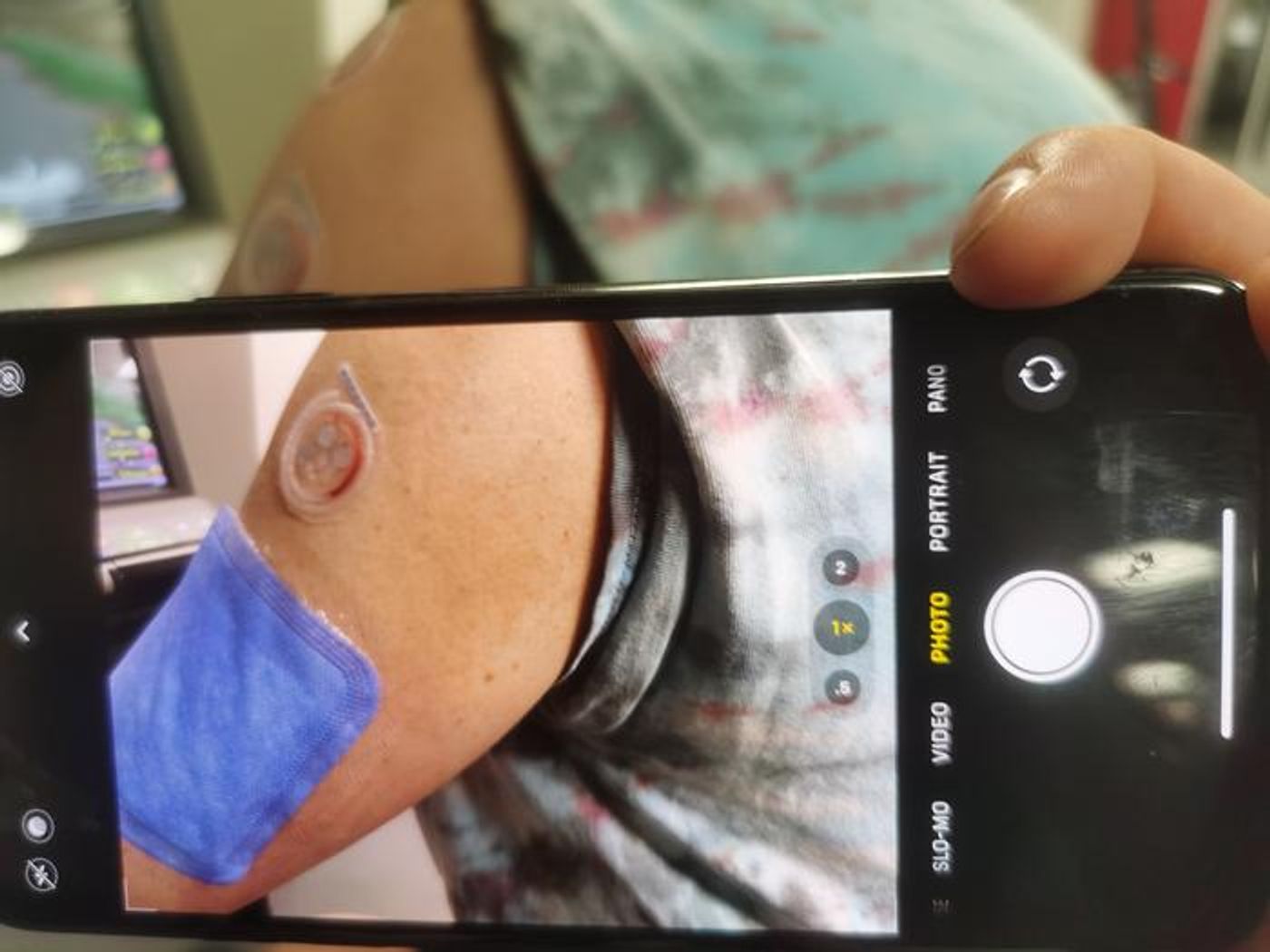 The health monitor measures sweat on a volunteer's arm. As part of the prototype testing, the sweat was dyed red. The blue patch was used for laboratory comparison. / Credit: Washington State University