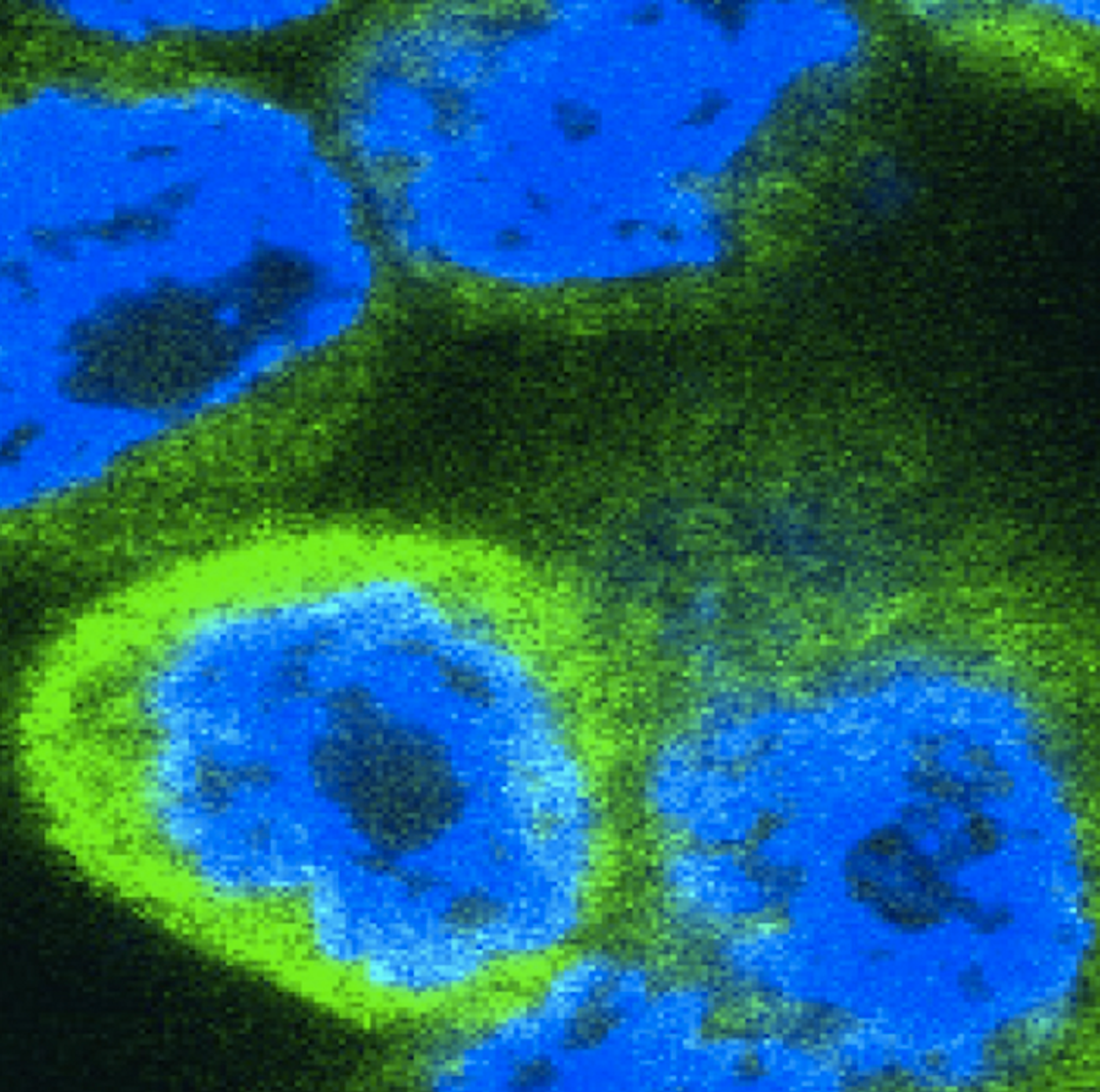 Human cells expressing inflammatory cytokines (stained green). Credit: Professor Martin Laboratory; Trinity College Dublin