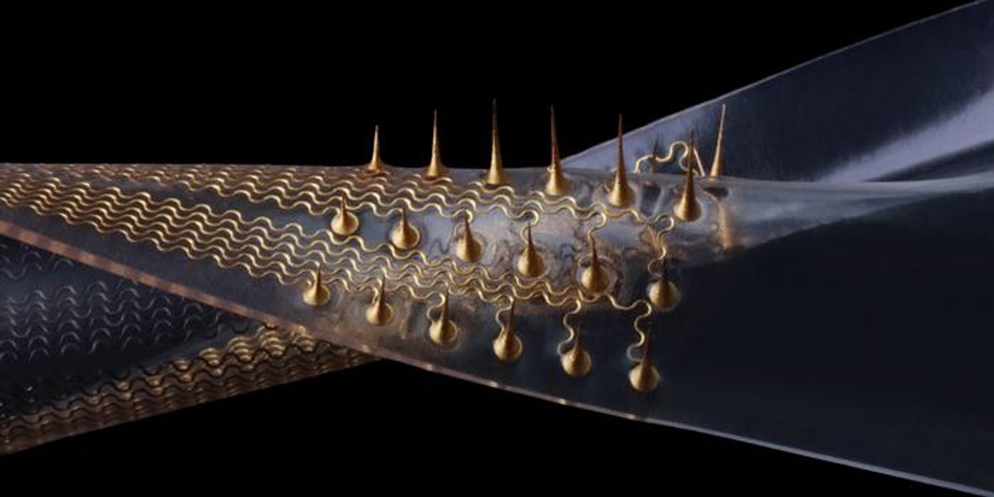Stretchable microneedle electrode arrays.  Credit  (PHOTO / Zhao Research Group)