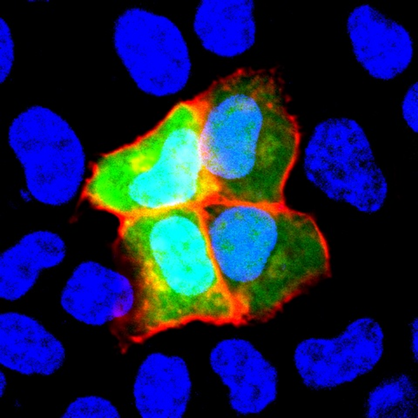 NCAM1 expression (green) is induced in HeLa cells, while an NCAM1 autoantibody in patient serum (red) reacts specifically to those cells / Image credit: Department of Psychiatry and Behavioral Sciences, TMDU