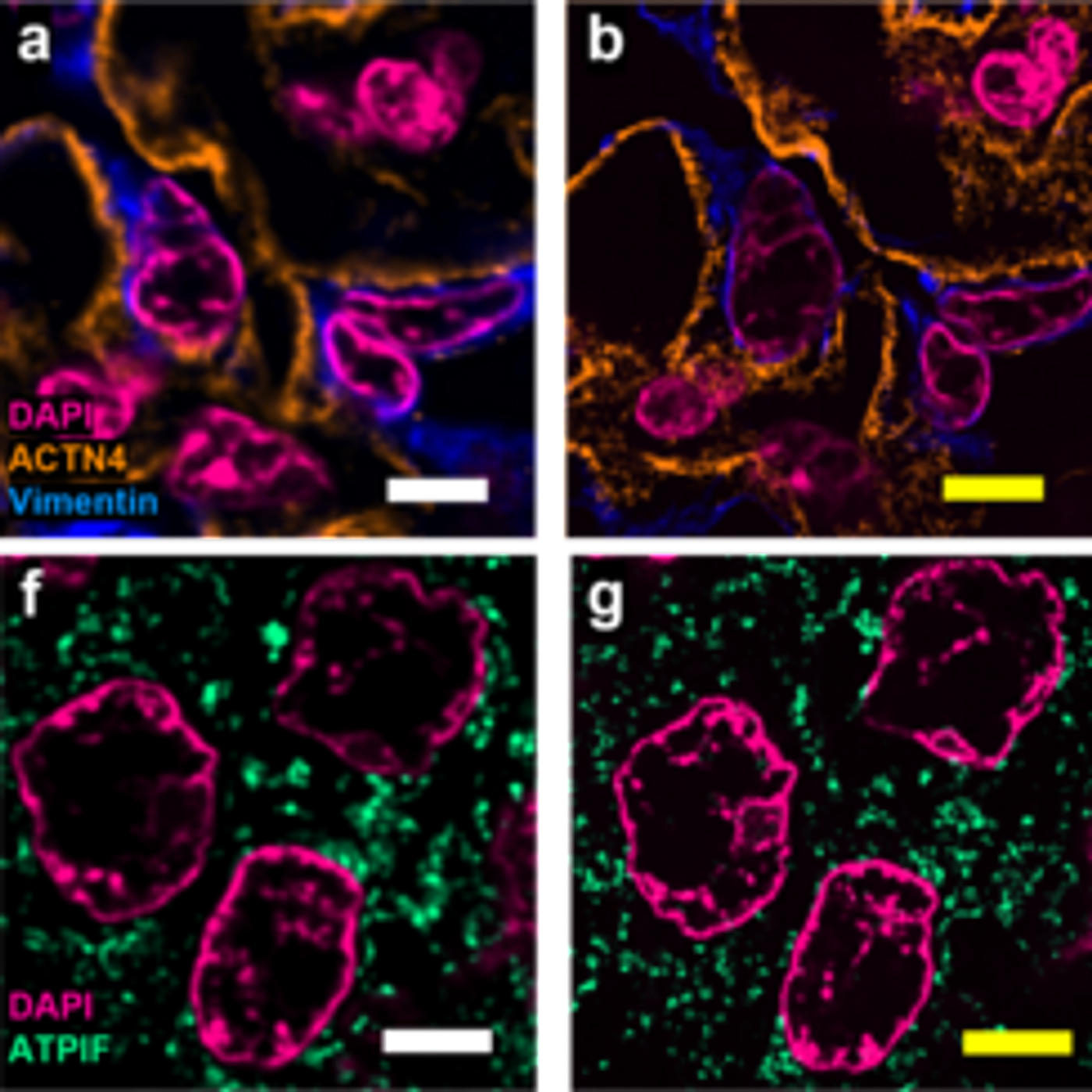 In this image from an unrelated study, samples can be seen after being treated with expansion microscopy.  Credit  Courtesy of Carnegie Mellon University