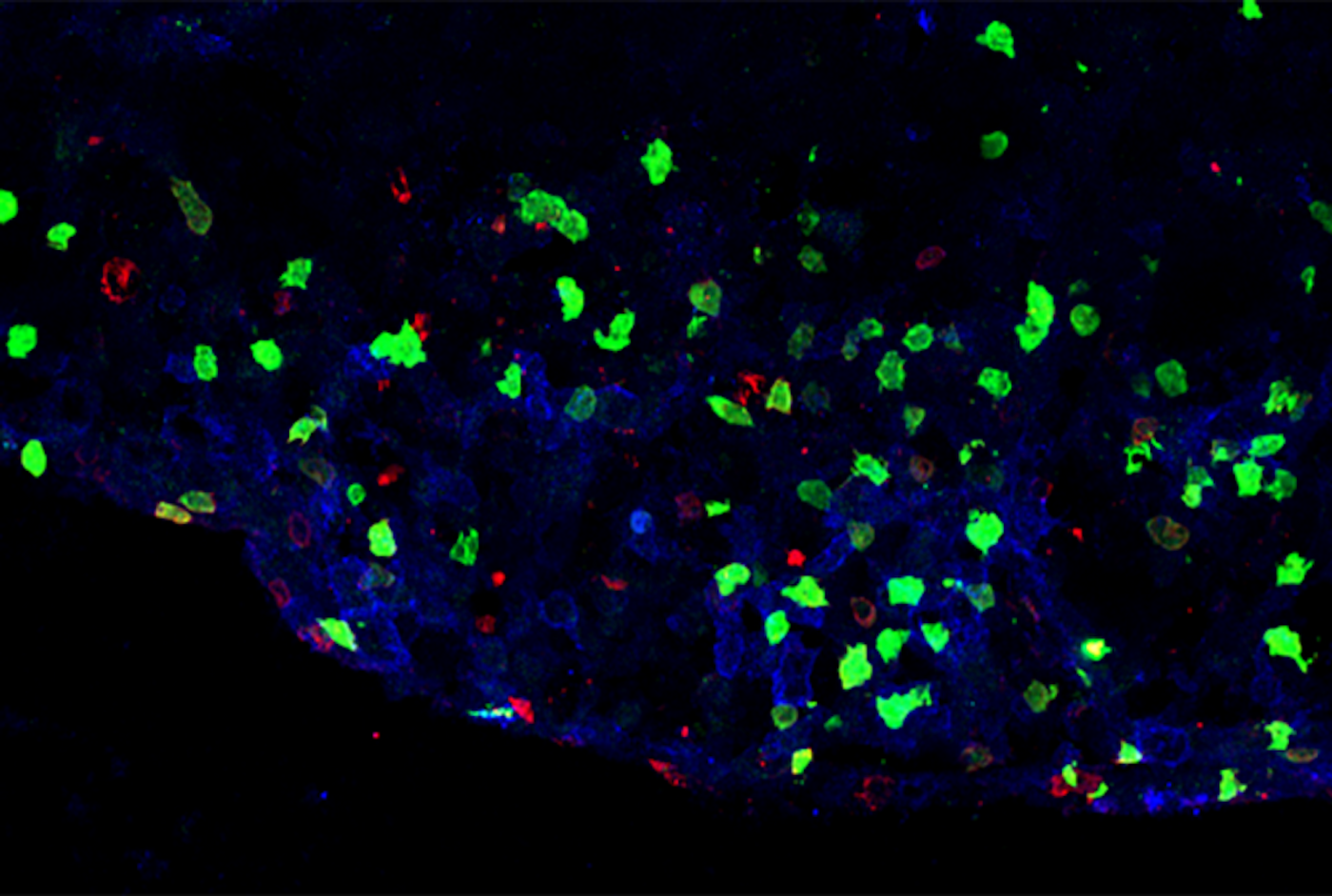 Inflammatory lesion in the spinal cord of a mouse model of multiple sclerosis demonstrating the presence of ILC3 (green) or T cells (red). Credit  Image courtesy of Dr. Christopher N. Parkhurst.
