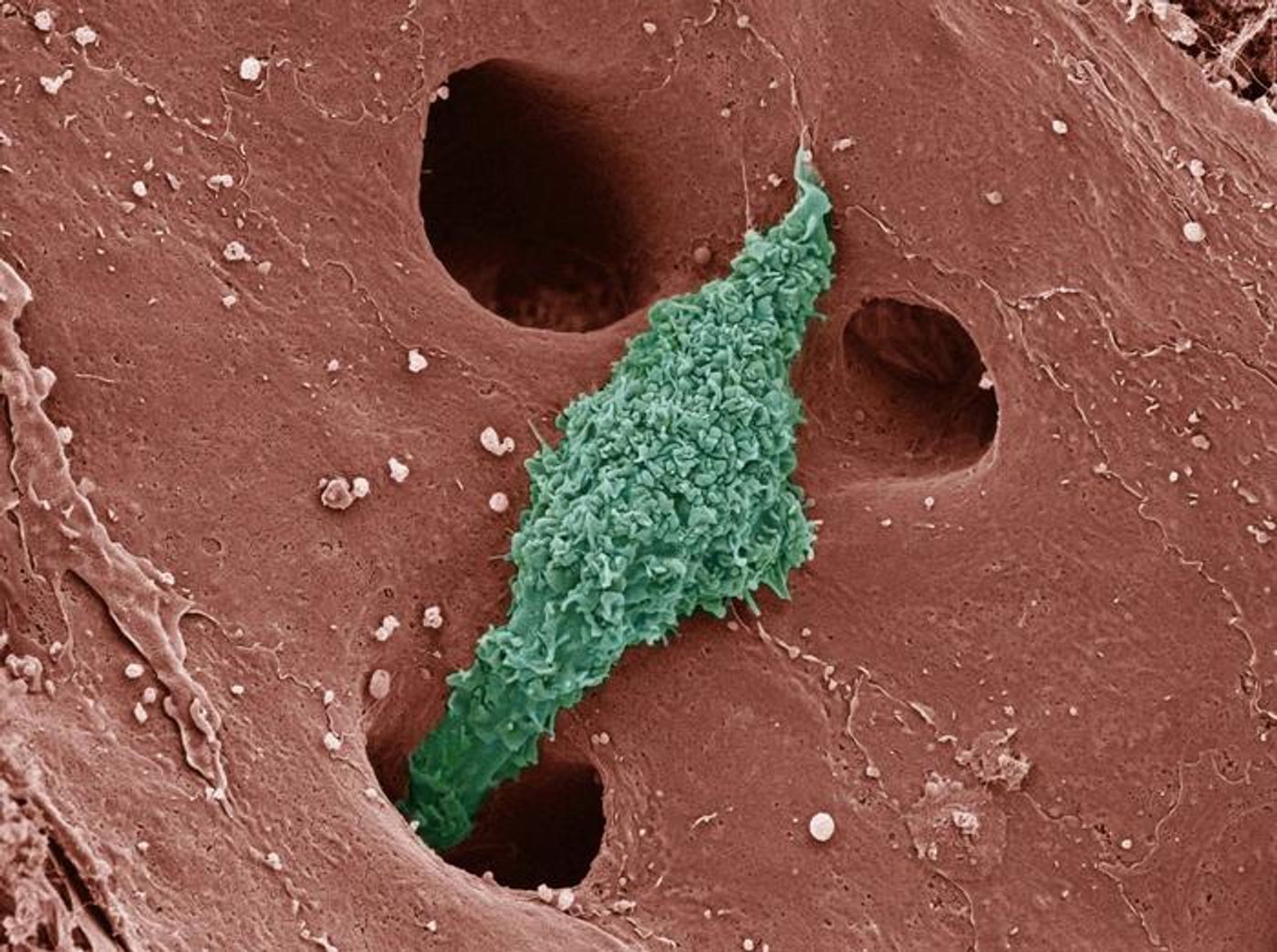 A colorized scanning electron micrograph depicts a Kupffer cell. / Credit: Thomas Deerinck, National Center for Microscopy and Imaging Research, UC San Diego.