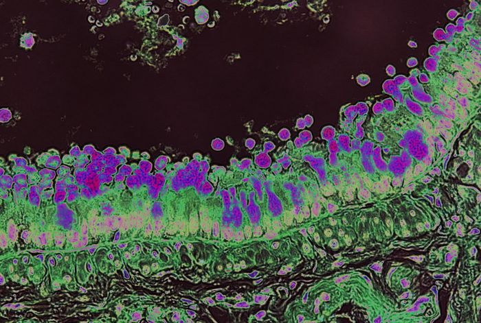 Color-enhanced goblet cells (dark purple) in lung epithelium / Credit: Dr. Mohammad Arifuzzaman and Dr. David Artis.
