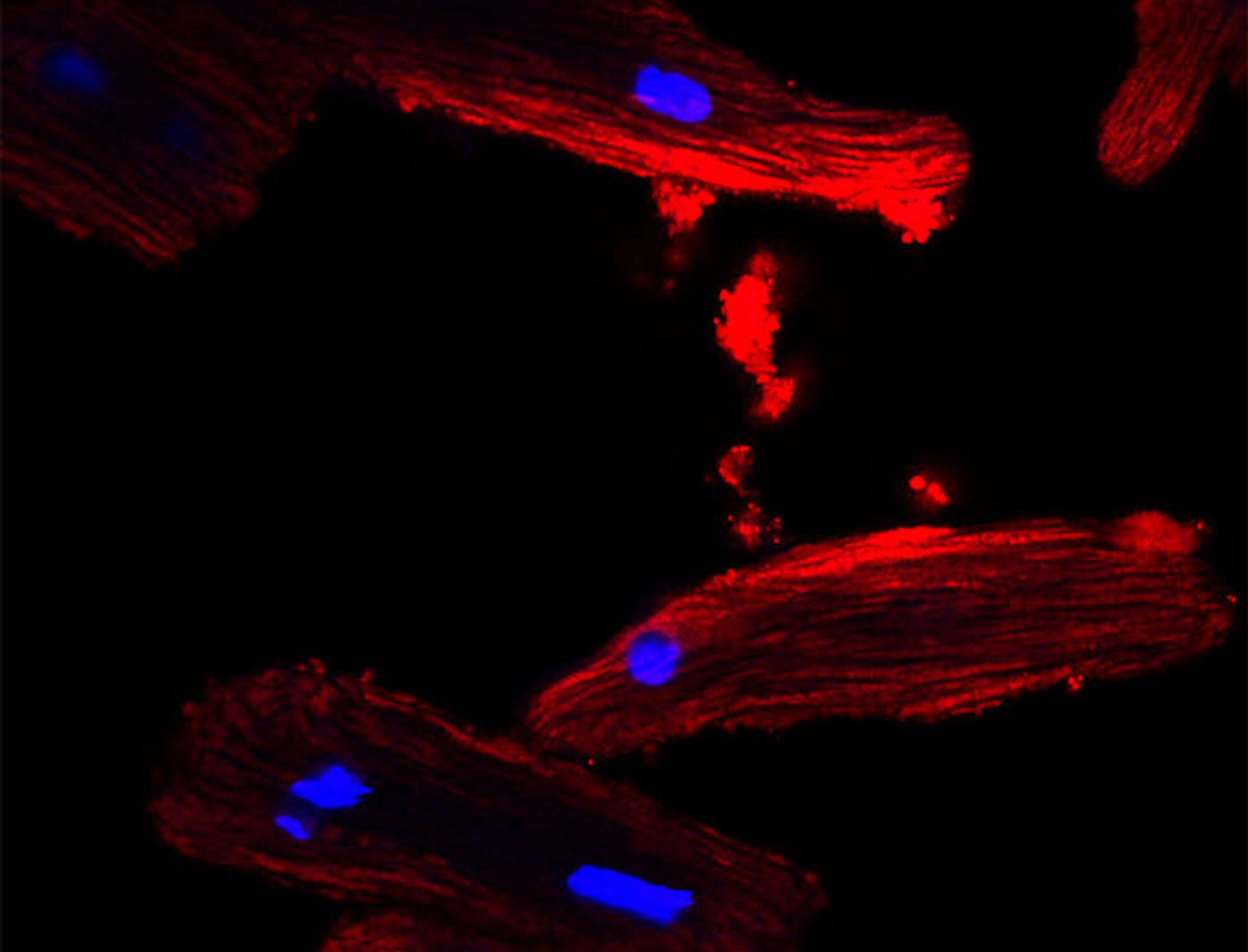 Image shows heart cells that have taken up red colored fat cell-derived extracellular vesicles. / Credit  UT Southwestern Medical Center