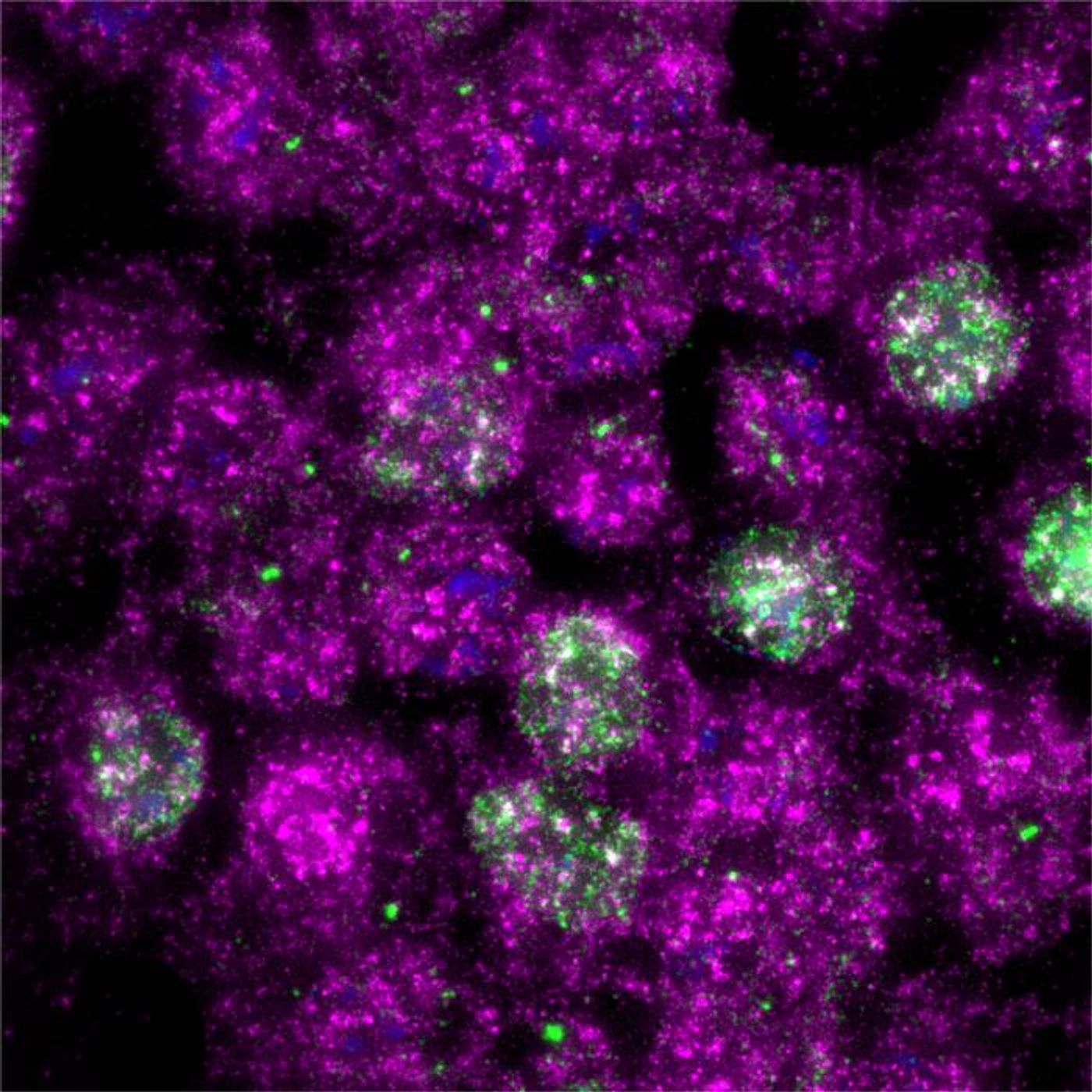 Immediately after UV exposure, ribosomes activate a widespread life-or-death pathway (pink), which is more pervasive than the DNA-initiated response (green). / Credit: Zhong Yeow and Niladri Sinha