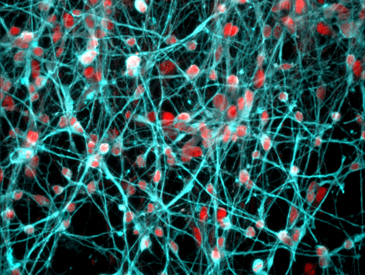 A magnified image of developing young human neurons. The mineralocorticoid receptor, coloured red, was found in the cell nucleus of these neurons. / Credit: University of Bristol