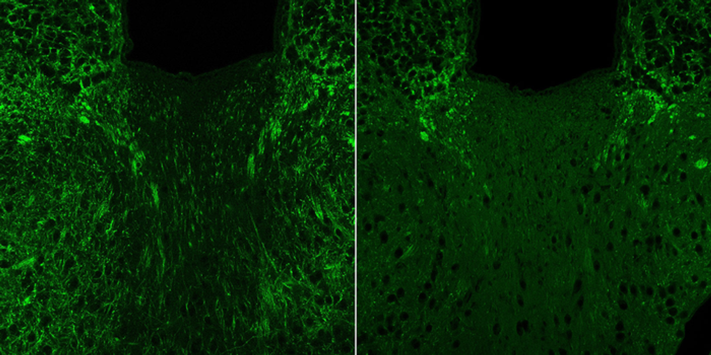 A mouse brain with normal myelin (green) production is seen at left, while in the presence of 4EPS, myelin production is stunted (right). / Credit: B. Needham / Caltech