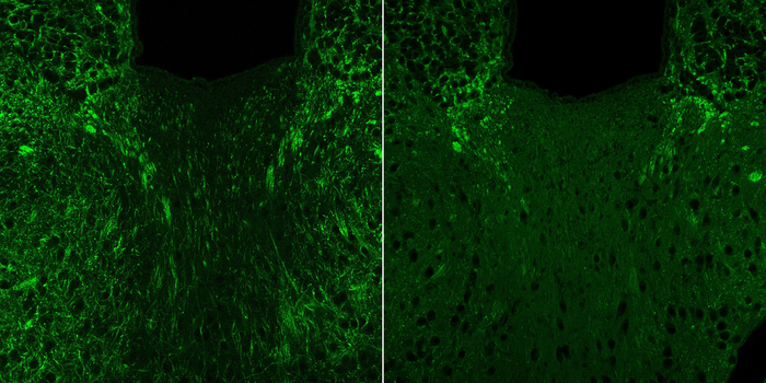 A mouse brain with normal myelin (green) production is seen at left, while in the presence of 4EPS, myelin production is stunted (right). / Credit: B. Needham / Caltech