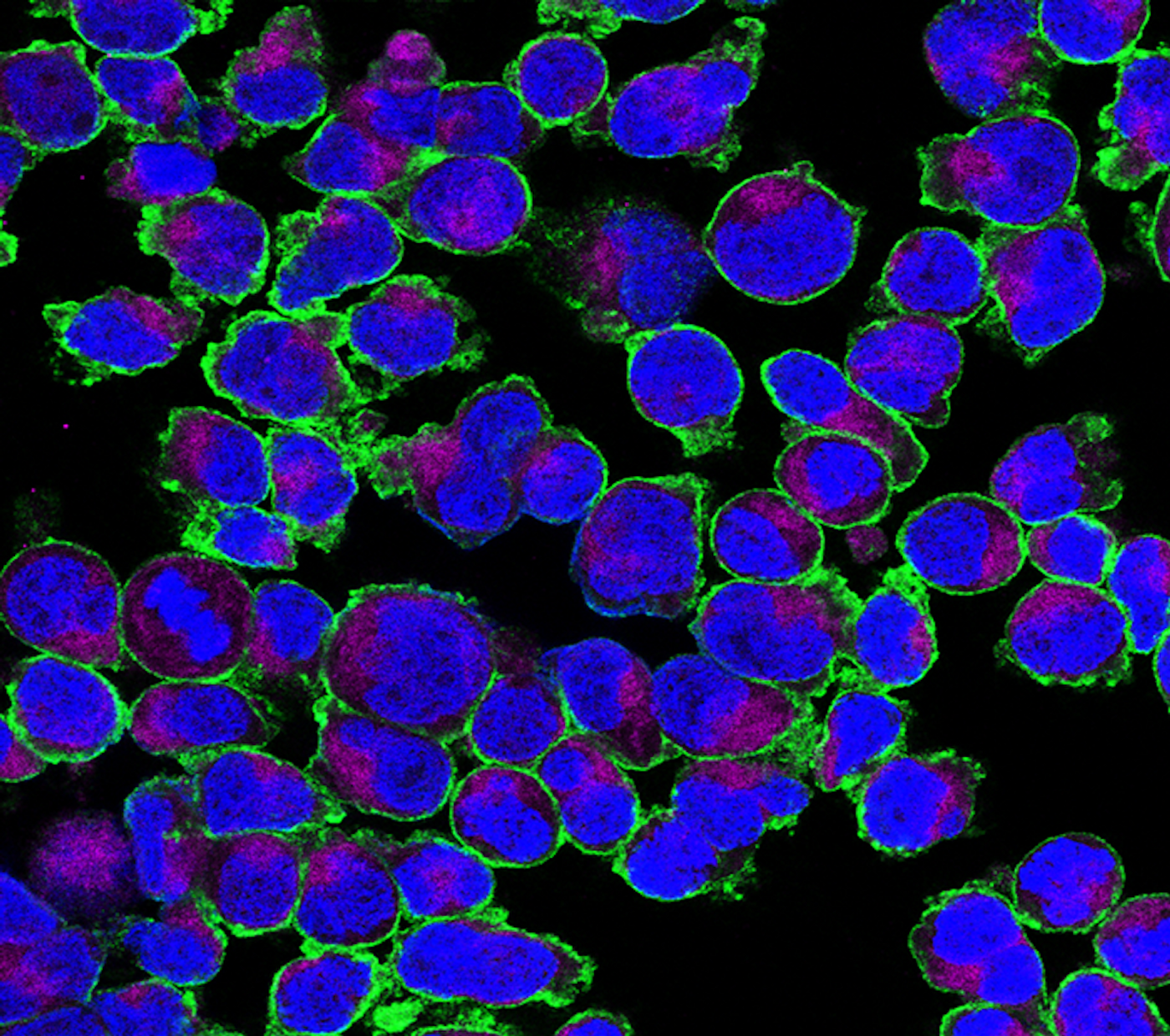 GLUT3 (green) on the surface of activated T cells, with mitochondria (violet) and the nucleus (blue). Photo: AG Väth