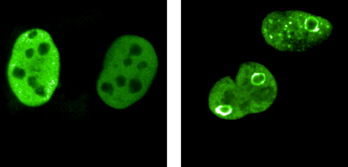 MYC proteins (green) are homogeneously distributed in the cell nucleus (left) in normally growing cells. Under stress, such as cancer, they rearrange themselves to form sphere-like structures that surround vulnerable sections of the genome. / Credit: Team Martin Eilers / University of Wuerzburg