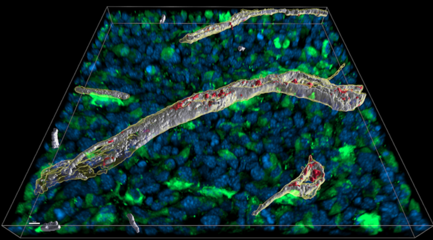 The areas in the blood vessel where interferon and heparan sulfate bind directly to each other can be seen spatially in white. Credit  Blankenstein Lab, Technology Platform Advanced Light Microscopy, Max Delbrück Center