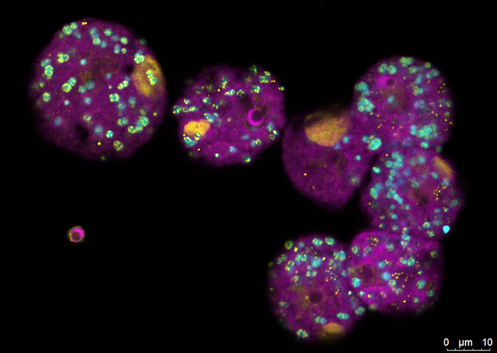 FISH (fluorescence in situ hybridization) of amoebae (magenta) infected with both Viennavirus (isolated and named in this study) and the bacterial symbiont (cyan) and virus factories in the initial phase & not generating infectious viruses (yellow) / Credit: Patrick Arthofer